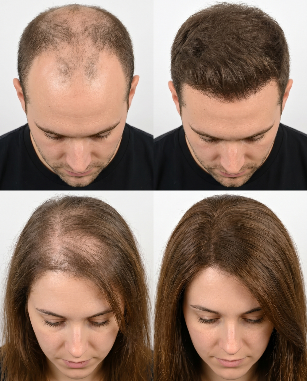 Illustrative hair before and after, individual results vary